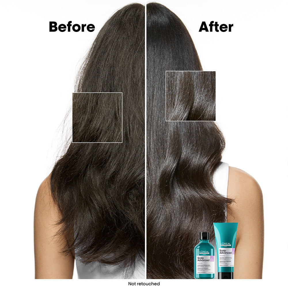 L'Oréal Professionnel Scalp Advanced Anti-Discomfort Shampoo 300ml