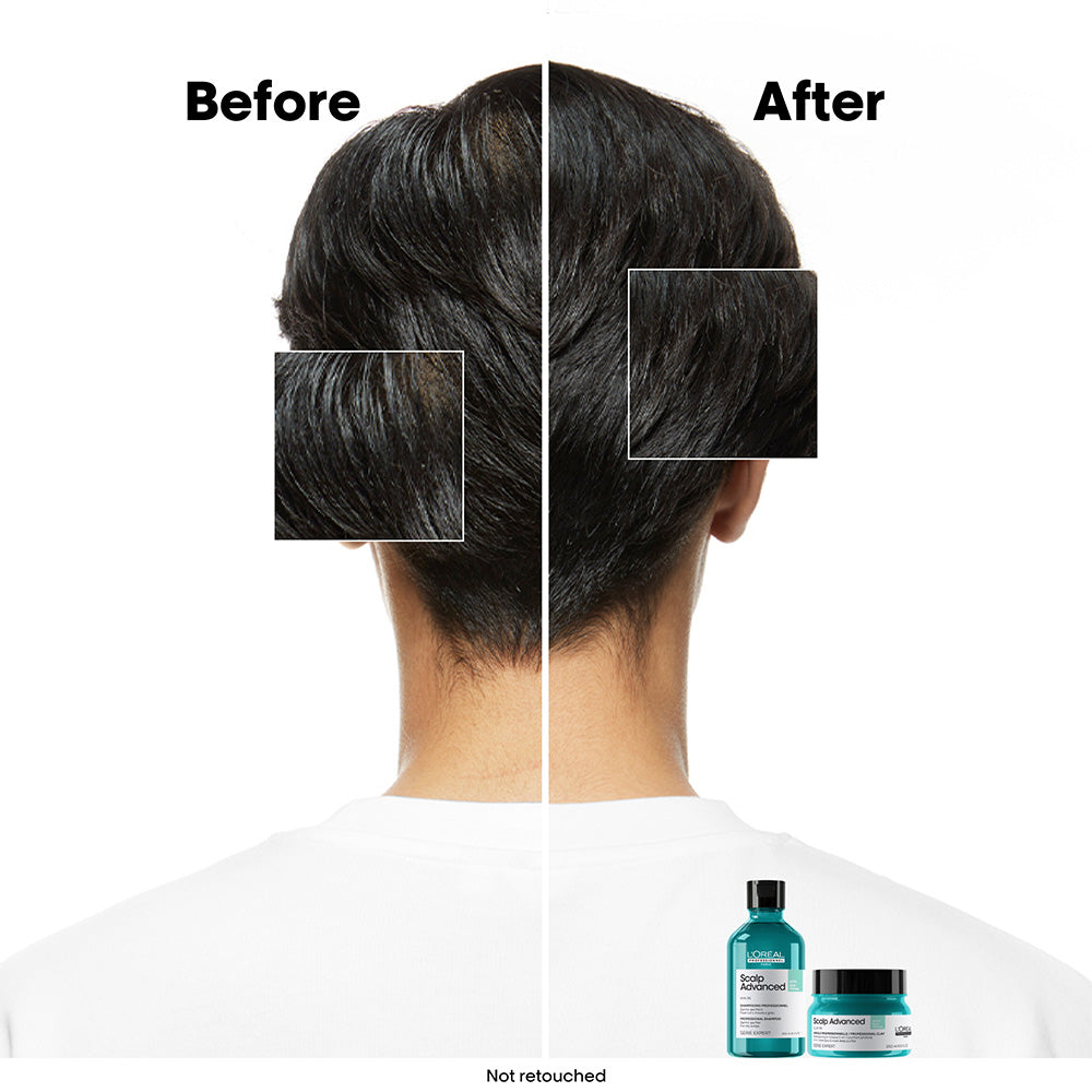 L'Oréal Professionnel Scalp Advanced Anti-Oiliness Shampoo 300ml