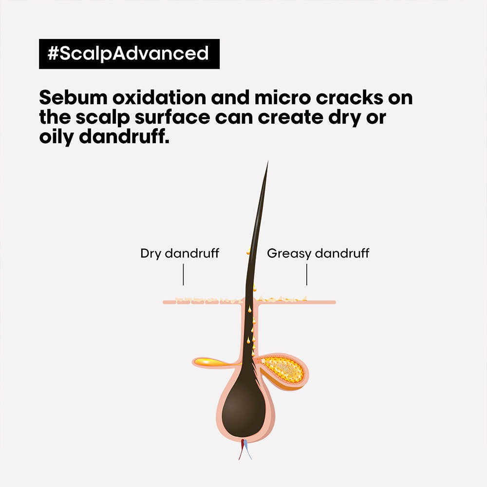 L'Oréal Professionnel Scalp Advanced Anti-Dandruff Shampoo 300ml