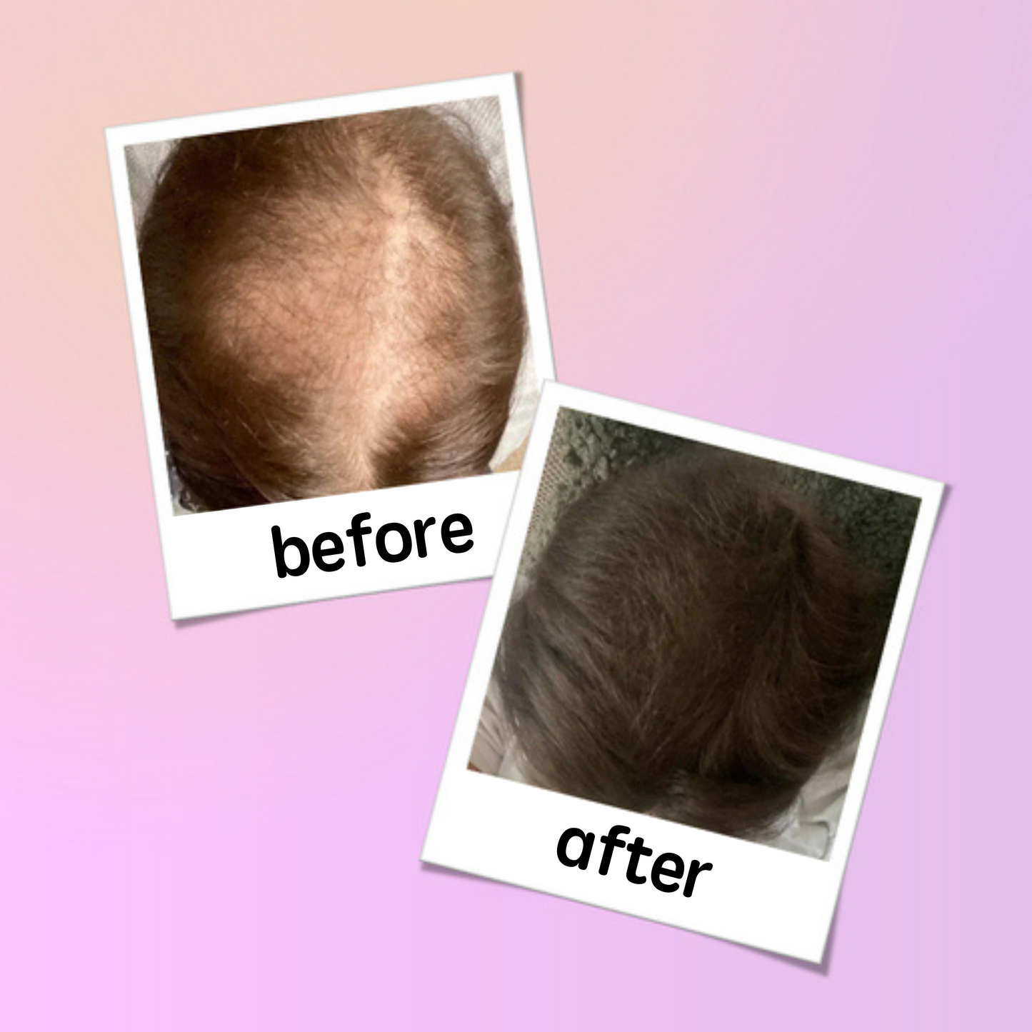 Georgiemane Hair Growth Spray 100ml