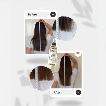 KN10 Hair Growth Elixir