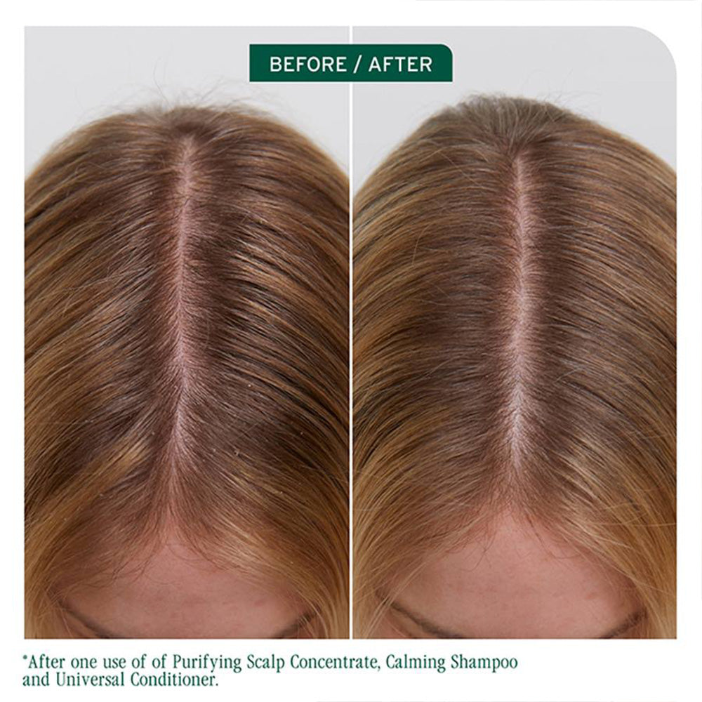 Matrix Scalp Sync Calming Shampoo 1L
