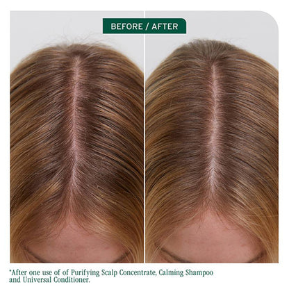 Matrix Scalp Sync Universal Conditoner 1L